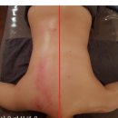 피부맑음 이미지