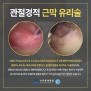 지속적으로 발바닥 통증이 나타나면 족저근막염을 의심해야 | 사우동가자연세병원 이미지