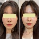오브에스떼 네이버블로그