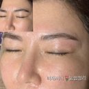 비채울