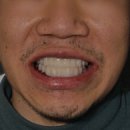 미라클원 이미지