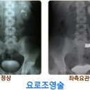 메디스톤비뇨기과 네이버블로그