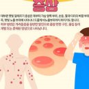 햇빛 알레르기 효능 및 증상 예방 이미지