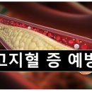 유연카레 이미지