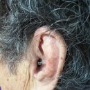 독일보청기 태평센터 이미지