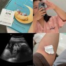 도구제일약국 | 분당제일여성병원 막달검사 제왕절개 수술 전 검사 후기