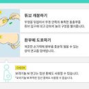 치질 통증 가려움 연고 추천 치질에좋은운동 이미지