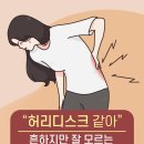 “허리디스크 같아...” 흔하지만 잘 모르는 ‘추간판 탈출증’ 특징 & 치료 이미지