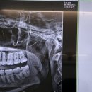 강남치과의원 | 강남, 강남사랑니치과의원