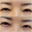 피부관리 올가드림뷰티 송천아이파크점 전북 전주시 덕진구 송천동1가 가격위치주소이벤트할인 총정리