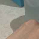 25시비디오 | 눈밑 눈가 주름 아이리쥬란 내돈내산 후기 효과 시술 후 관리