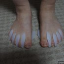 손태석 발가락운동용구 이미지