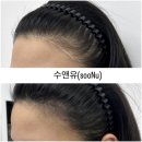 진헤어라인 이미지
