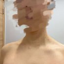 최유섭피부과의원 | 경기도 평택시 신평동 대상포진 전문병원 추천 | 무료접종 | 예방접종