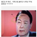 왕자 대신 터럭(毛,용수)붙이고 나타난 무속 중독인..윤석열(스킨컬러테이프) 이미지