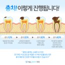 서울플란트치과의원 이미지