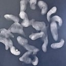 리리유의원 | 유방 미세 석회화, 유방암의 공포에 대하여) 서울 강남 유방 건강검진, 병원 추천 맘모톰, 맘모툼후기