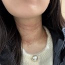 메종드엠의원 | 메종드엠의원에서 목주름 필러 시술받음 (내 돈 내산 후기)