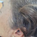 독일렉스톤보청기수원점 | 중도난청도 편안한 일상 회복 할 수 있었던 시그니아 렉스톤 독일보청기 독일렉스톤보청기 수원점