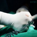 드림헤어라인의원 네이버블로그