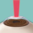 연세바른안과의원 이미지