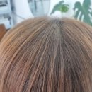 김해대로 2505번길 | 정수리 모류교정후 자라난 모습, 오해와 진실!