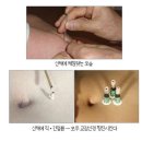 고려수지침 이미지