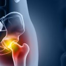 뉴로하이짐 이미지