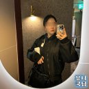 내돈내산 분당 톡스앤필 스테로이드 no! 윤곽주사 후기