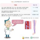 심장부정맥 고주파·냉각절제술 치료비(급여)(연간1회한)(1 년50%) 특별약관 이미지