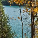 샤토로리에2 | 소파술 후 몸조리/고통/여행/체크업