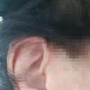 귀가 트인 솔직후기 | 굿모닝보청기 대구 수성센터