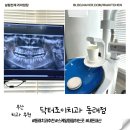 동래치과 닥터조이치과의원 스케일링 과잉진료없는곳 내돈내산 후기