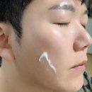 리얼픽셀 | 인생 기미잡티 싹 지웠다? 모공축소까지?! 니들샷 피부 혁명, 이츠비 픽셀라이트 스탠다드 리얼 사용 후기!