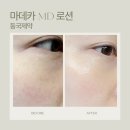 동국마음요양병원 | 동국제약 마데카MD로션 피부과 제품 사용 후기(극건성·아토피 피부 내돈내산 1달 사용 후기)
