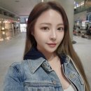 여자헤어라인교정 비절개 히든컷 9개월 후기