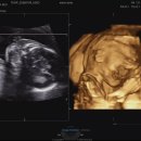 황실목욕탕 | 경주 맘존여성병원 21주차 임산부 정밀초음파 검사&amp;아기성별 후기(각도법,황실달력)