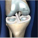 바디케어짐 이미지