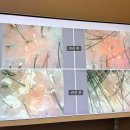 닥터드라이 | 운정두피관리 추천｜닥터 모다르 운정점 두피케어 전후 비교 후기