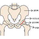 통증에 허리 아닌 '골반' 부여잡는다면… 이미지