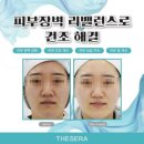 필에어 이미지