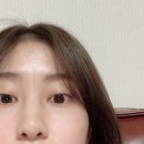 애크닉 | 광주 여드름 관리 : 애크닉