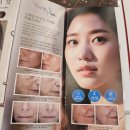 BBL레이저 후기 :: 비용/효과 내돈내받