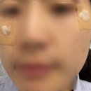 고운얼굴의원 | 부산 흑자 제거 - 맑고고운의원