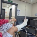 멍발머리 | MBO 발목 인대 재건술 후기 (1)_ 대전 mbo 수술, 뼛조각 제거, 발목 불안정성 수술