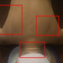 신유베라트 | 김포피부관리 어썸에스테틱 거북목 등관리 후기