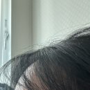 뷰티앤영의원 이미지