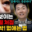 지식한상/불룩한 눈 밑 처짐 성형외과 반재상 원장 이미지