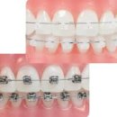 이편한치과 앞 사거리 | 서울 강남 치아교정 치과 먹튀 피해 후 재교정 비용 후기