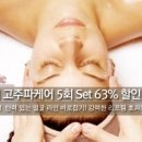 엑사커머스
